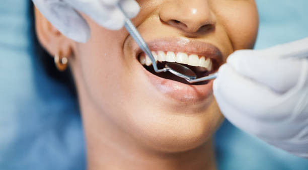 Best Emergency Root Canal Treatment in Hazel Dell, WA