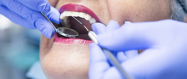 Best Emergency Dental Surgery in Hazel Dell, WA